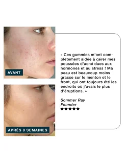 Clarity Anti-Blemish Gummies