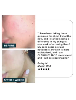 Glow Skincare Gummies