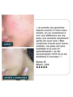 Glow Skincare Gummies