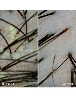 Scalp Remedy Shampoo