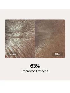 Skincare Serum and Cream Starter Kit