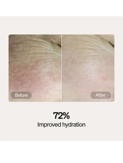 Skincare Serum and Cream Starter Kit